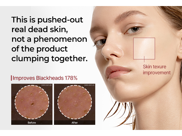 DR.MELAXIN PEEL SHOT LINE Sanft peelende Ampulle mit weißem Reisextrakt 80 ml #7